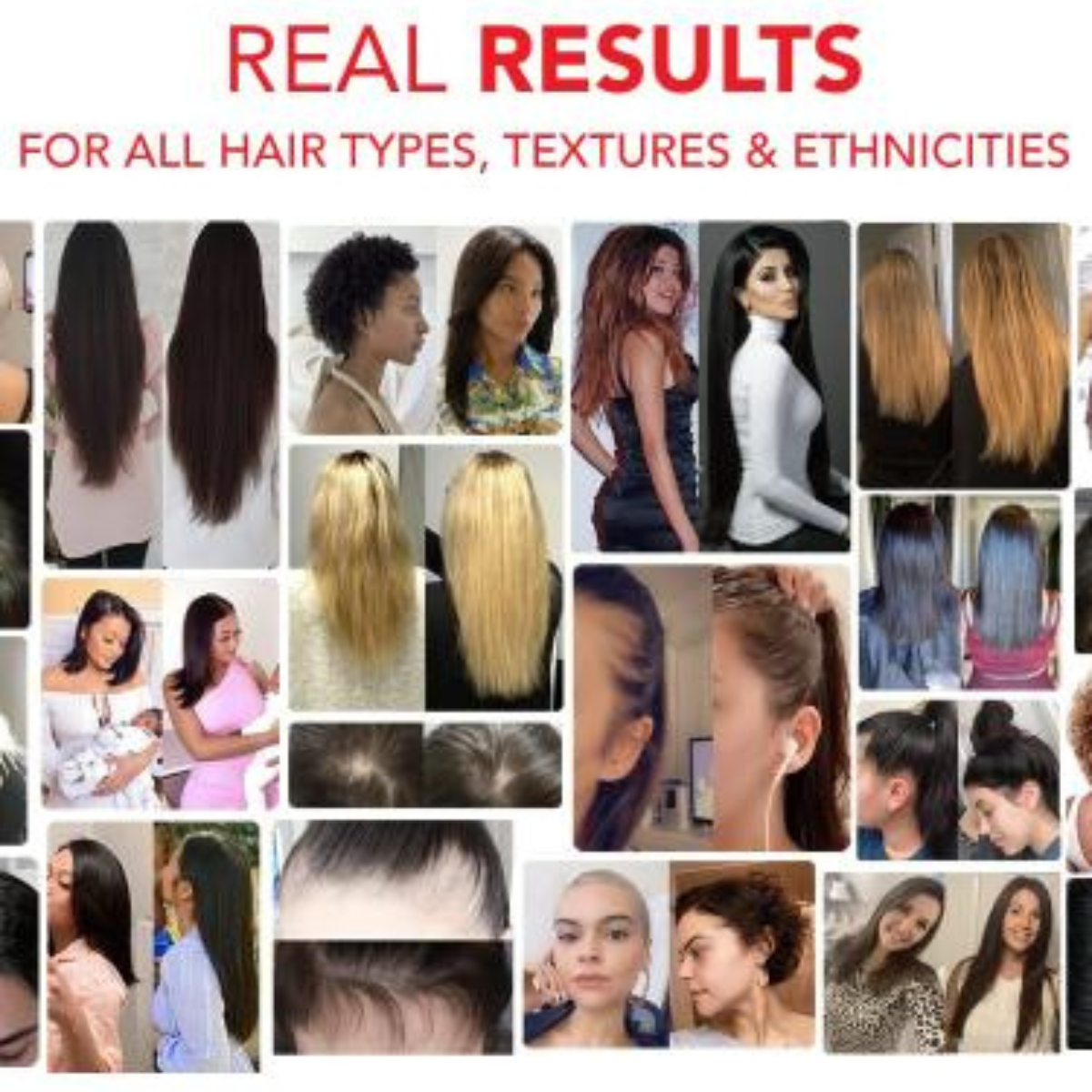 HAIRtamin Vegan Hair Vitamins for Faster Hair Growth, 30 capsules, Single Unit 1