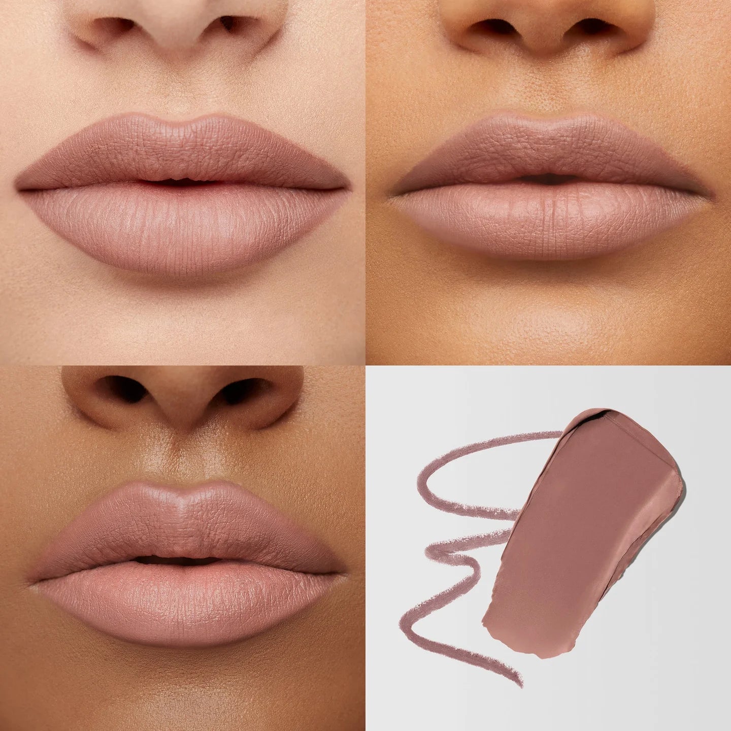 Mario's Lip Lift™ Kit