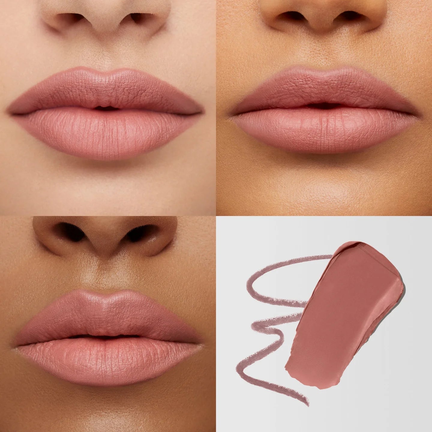 Mario's Lip Lift™ Kit